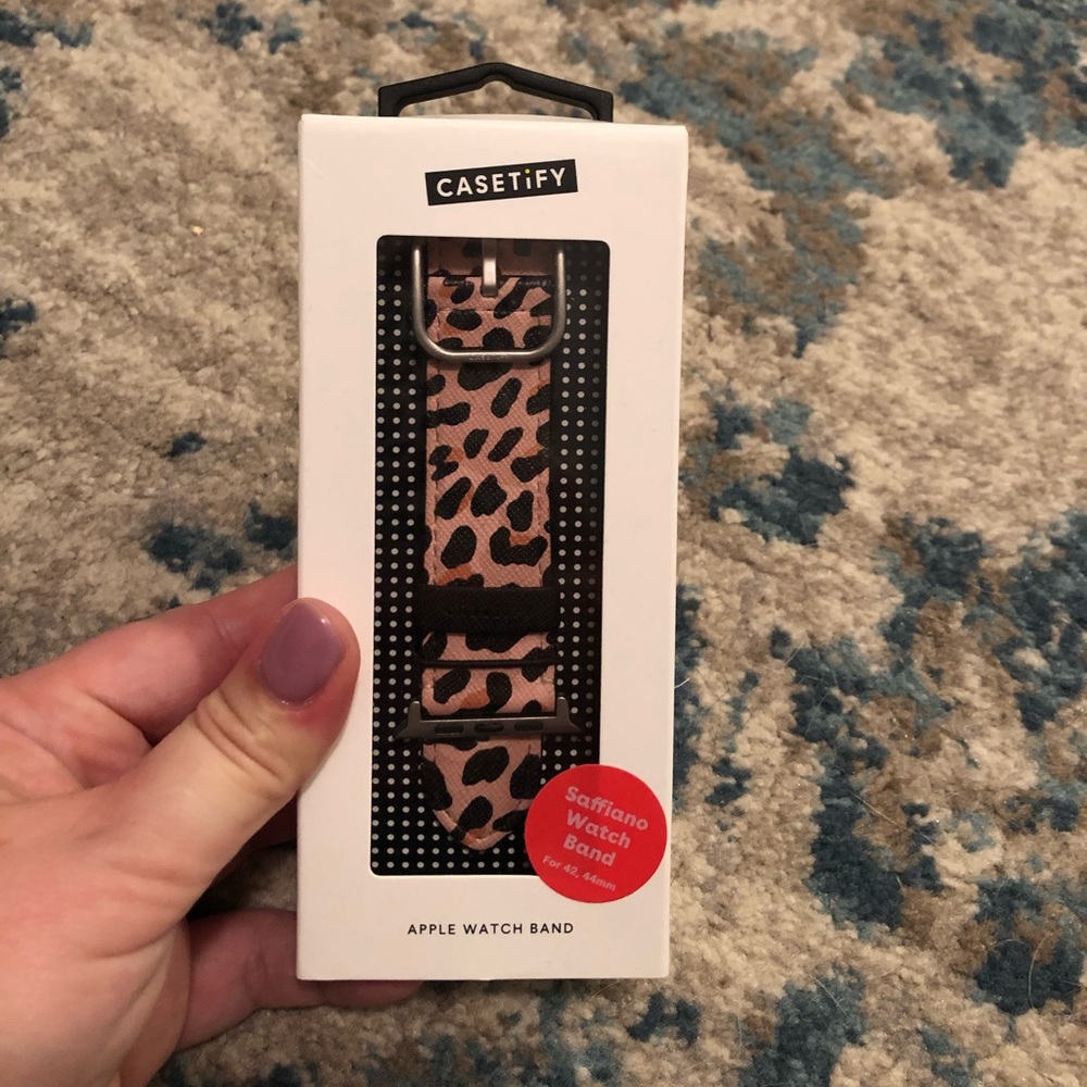 Casetify Apple Watch band
